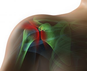 Rotator Cuff